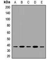 Anti-JMJD8 Antibody