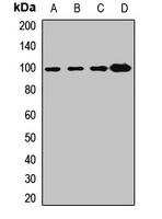 Anti-Gamma-COP Antibody
