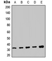 Anti-TRMT61A Antibody