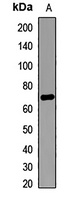 Anti-ACSVL1 Antibody