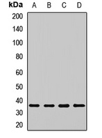 Anti-PSMD14 Antibody