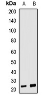 Anti-Neurotrophin 4 Antibody
