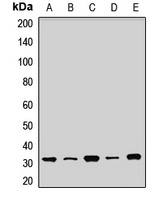 Anti-SDHB Antibody