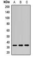 Anti-HO-1 Antibody