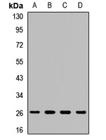 Anti-COX2 Antibody