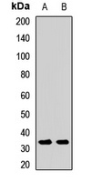 Anti-SOX2 Antibody