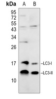 Anti-LC3-I/II Antibody
