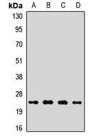 Anti-COX2 Antibody