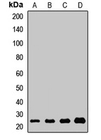 Anti-ICT1 Antibody