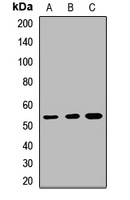 Anti-KDM8 Antibody