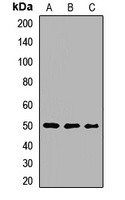 Anti-MAGEA4 Antibody