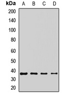 Anti-MC3 Receptor Antibody