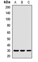Anti-EXOSC3 Antibody