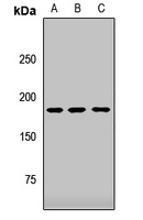 ZCCHC11 antibody