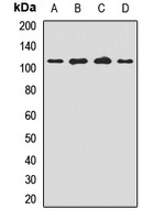 MTSS1 antibody