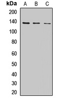 CHAMP1 antibody