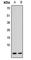 Anti-Bet1L Antibody