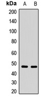 Anti-NPTX2 Antibody