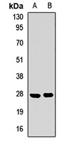 Anti-SPRR3 Antibody