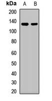 Anti-SART3 Antibody