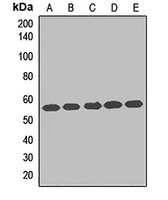 Anti-TCP1 eta Antibody