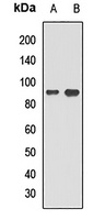 Anti-CDT2 Antibody