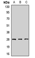 Anti-SNRPA1 Antibody