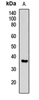 Anti-SRPX Antibody
