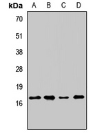 Anti-AGTRAP Antibody