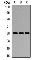 Anti-Agmatinase Antibody