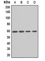 Anti-IP6K1 Antibody