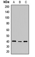 Anti-SHARPIN Antibody