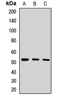 Anti-PORCN Antibody