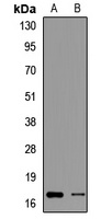 Anti-PFDN2 Antibody