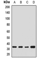 Anti-TRAX Antibody