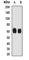 Anti-CD55 Antibody