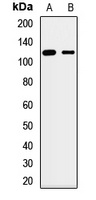 Anti-SLC12A7 Antibody