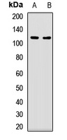 Anti-UBA1 Antibody