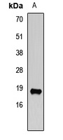 Anti-VAMP2 Antibody