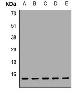 Anti-UQCRB Antibody