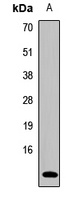 Anti-Ghrelin Antibody