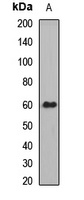Anti-UGT1A1 Antibody