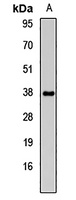 Anti-OGG1 Antibody