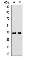 GNB3 antibody