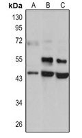 Anti-AGER Antibody