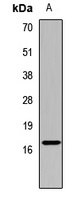 Interferon gamma antibody