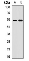 Anti-Fetuin A Antibody
