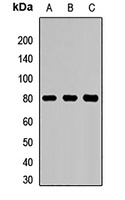 SLC22A5 antibody
