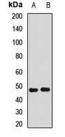 Anti-ERR alpha Antibody