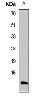 Anti-POLR2F Antibody